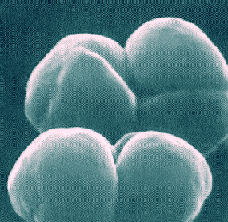 Methanosarcina, een soort oerbacterie.  Bron: Wikimedia Commons
