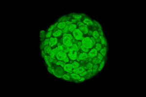 Een cel van een muis zonder TDP-43, maar met een vervangend eiwit, hier gemarkeerd in groen. Beeld: Jonathan Ling/Johns Hopkins Medicine