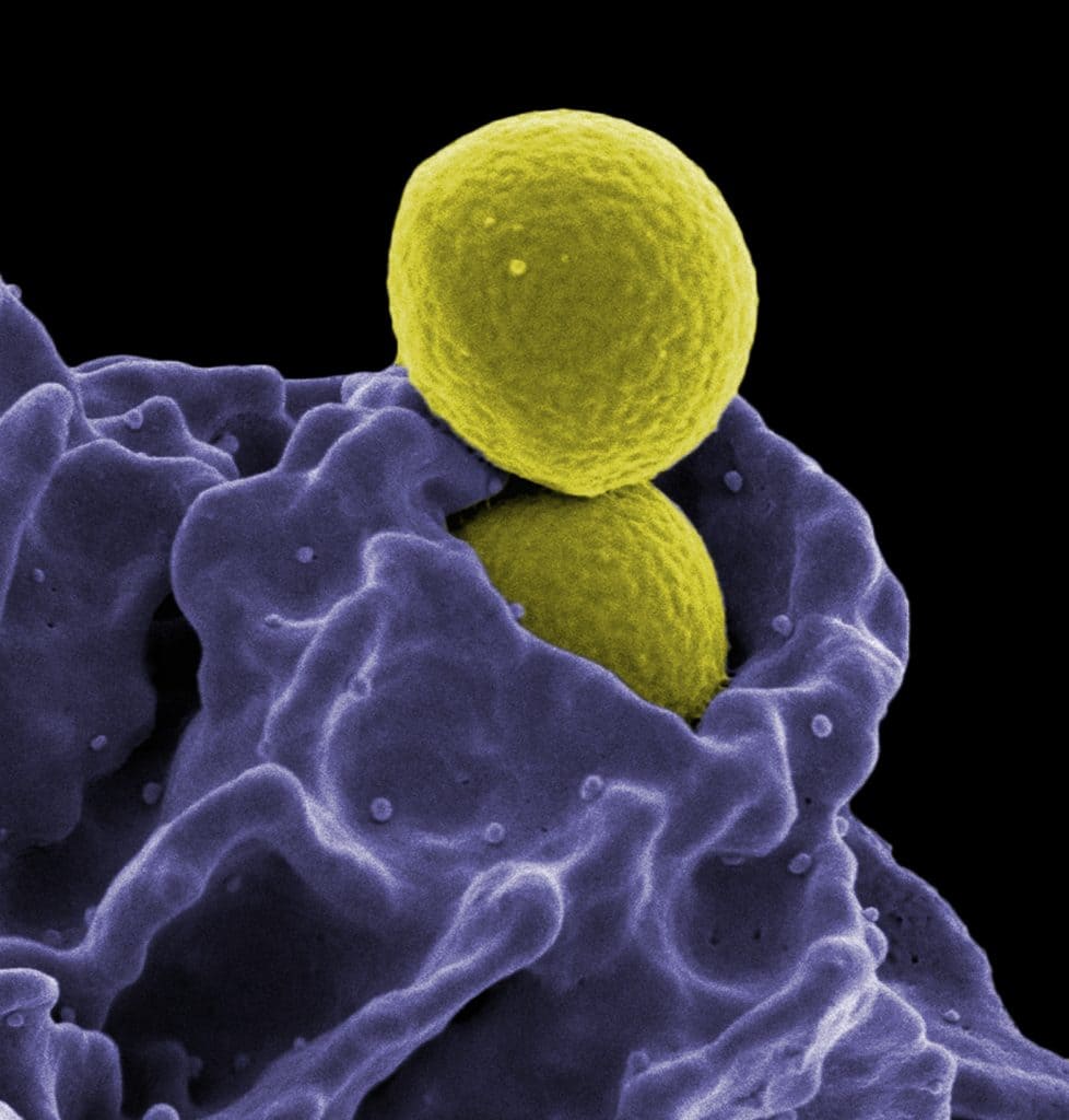 Bacteriën worden door onze immuuncellen opgeslokt.