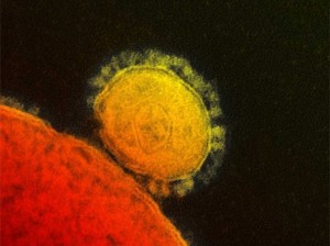 MERS-virus. Credit: Rocky Mountain Laboratories, National Institute of Allergy and Infectious Diseases, NIH