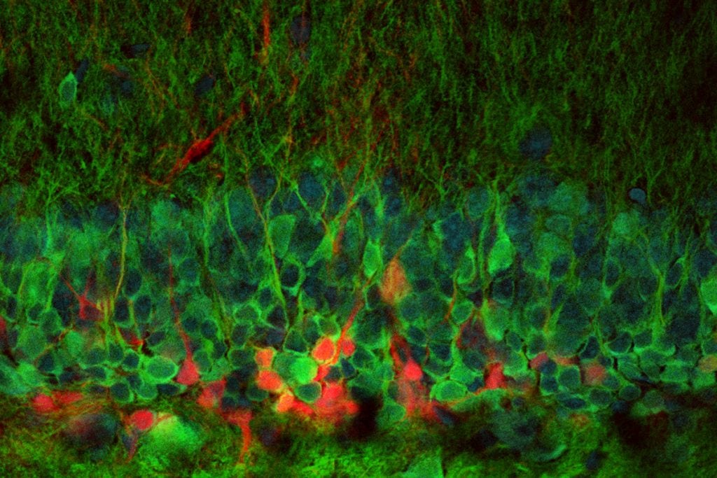 In een muizenbrein worden nieuwe neuronen aangemaakt (rood weergegeven). Afbeelding: Nathan Danielson, Losonczy Lab, Columbia University