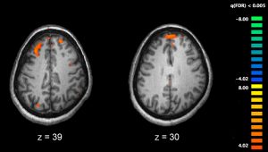 Schizophrenia_fMRI_working_memory