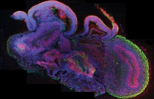 Een dwarsdoorsnede van een minibrein toont de ontwikkeling van verschillende hersengebieden. De stamcellen zijn rood, de hersencellen zijn groen. Bron: Madeline A. Lancaster