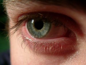 Volgend jaar zullen blinde mensen voor het eerst een bionisch oog krijgen. Foto: Samuel Johnson