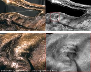 Tatoeages op het lichaam van Ötzi. Klik voor grotere versie.