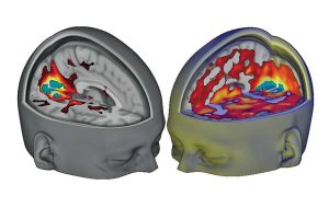 Hersenscans tonen de invloed van LSD op het brein. Bron: Carhart-Harris et al.