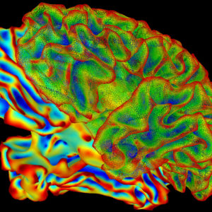 Hersentumoren wellicht beter te behandelen door middel van techniek die bloed-hersenbarrière opent