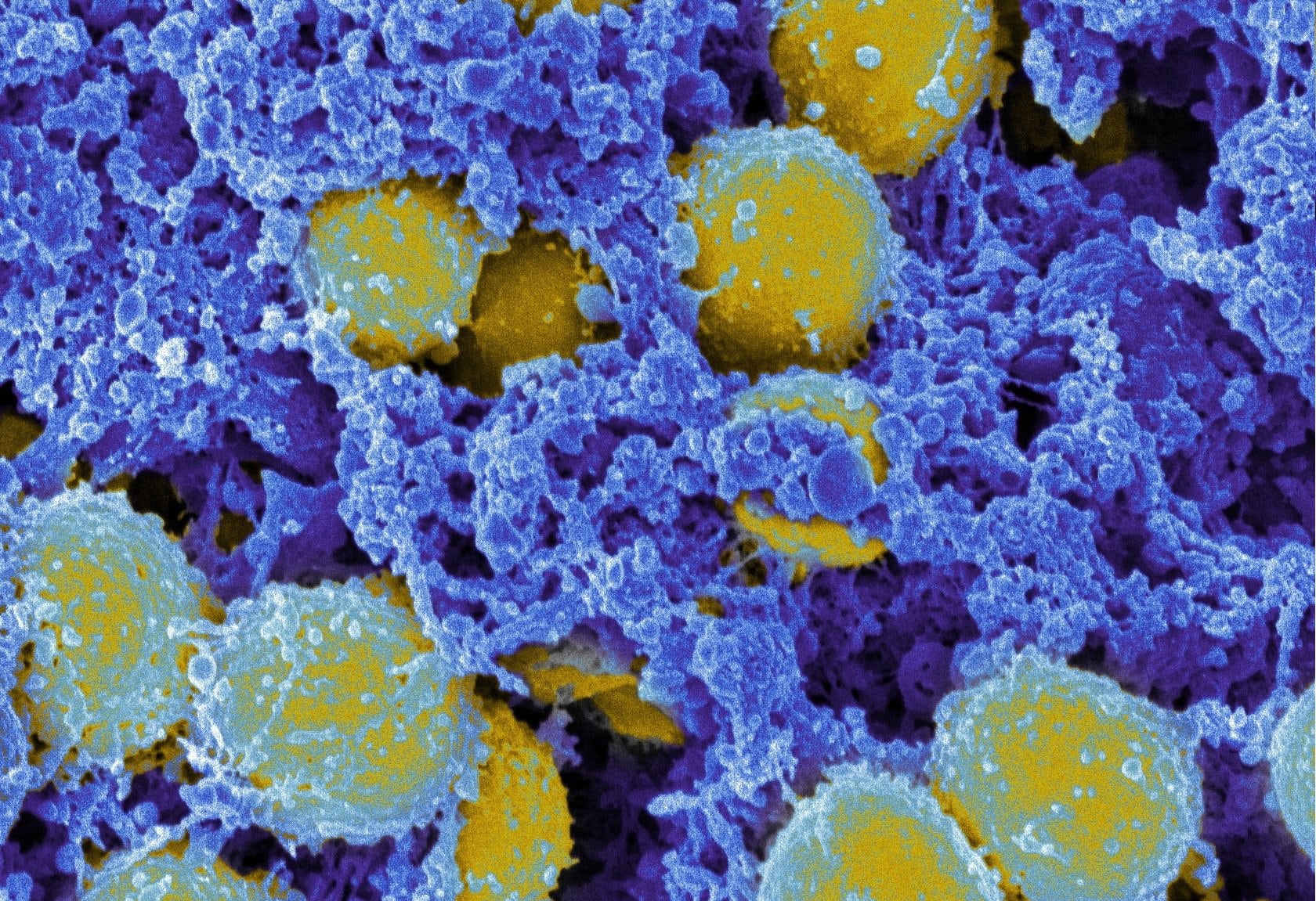 Staphylococcus aureus 3. Золотистый стафилококк под микроскопом. S. aureus золотистый стафилококк. Метициллин-резистентный золотистый стафилококк.