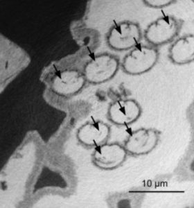 Een röntgenbeeld van het sperma van de fossiele mosselkreeftjes. De celkern, waarin de DNA-dragende chromosomen zaten, zijn te zien als donkere vlekjes die met pijltjes zijn aangegeven. Bron: R. Matzke-Karasz
