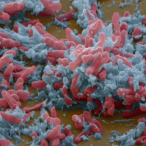 De verrassende oorsprong van tbc, de dodelijkste ziekte in de menselijke geschiedenis