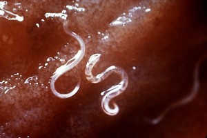 Bacteriën die worden gebruikt in Japans eten genezen haakworminfecties – althans bij hamsters. Verdere studies moeten uitwijzen of er een medicijn kan worden ontwikkeld speciaal voor mensen.