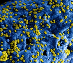 Foto met elektronenmicroscoop van het MERS-virus op het oppervlak van een cel. Foto: NIAID