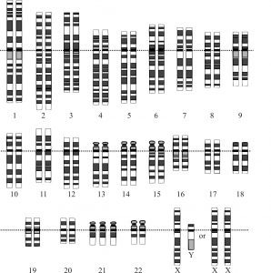 Trisomie21